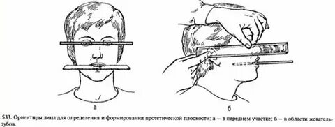 Этапы определения центрального соотношения