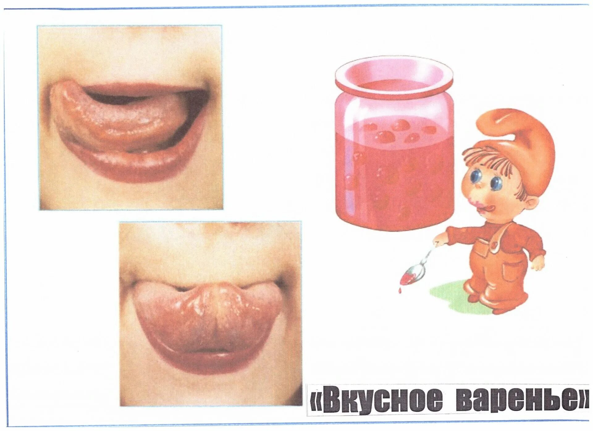 Артикуляционная гимнастика для детей вкусное варенье. Артикуляционная гимнастика варенье. Артикуляционная гимнастика варенье. Артикуляционная гимнастика варенье. Вкусное варенье логопедическое упражнение.