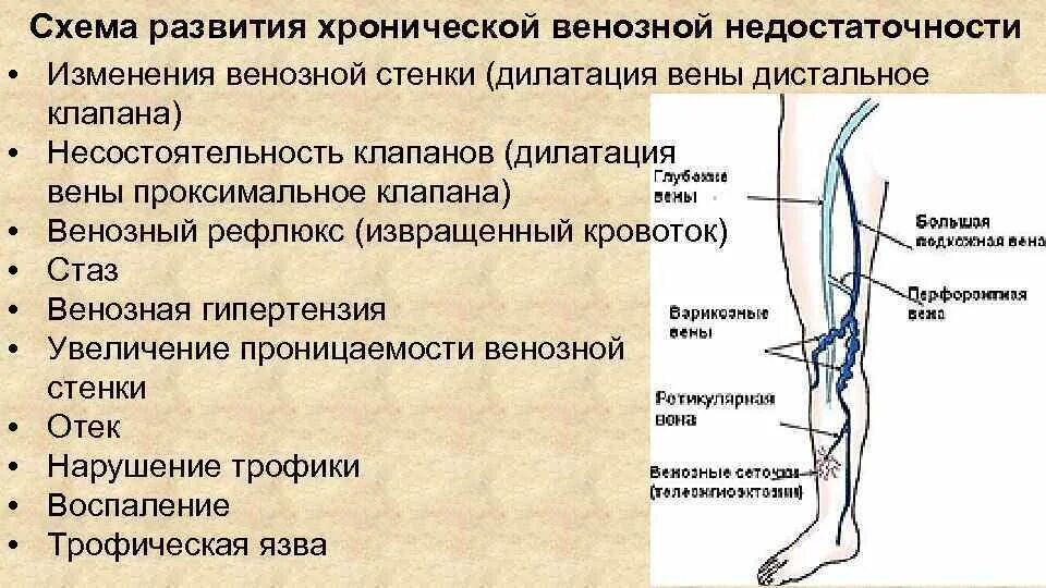 Перфорантные вены голени несостоятельные клапаны. Схема развития хронической венозной недостаточности. Недостаточность венозных клапанов. Клапаны в венах нижних конечностей.