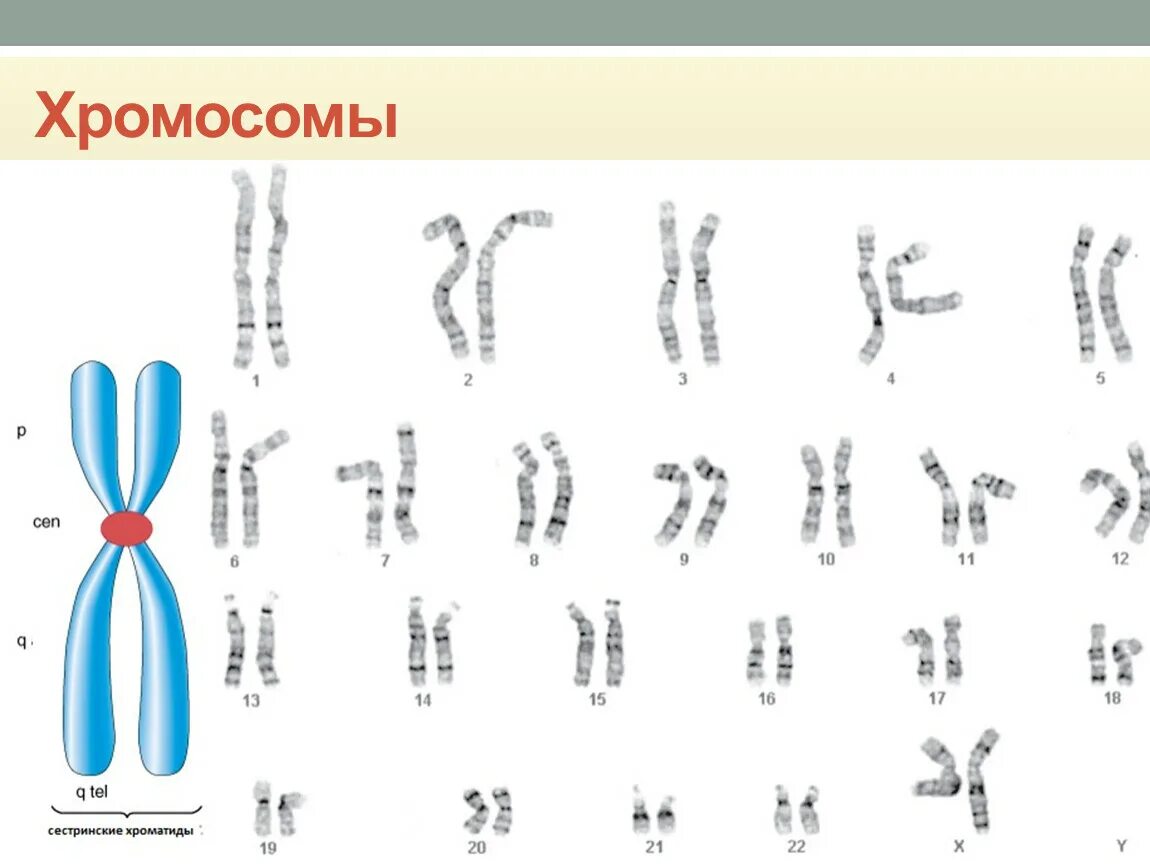 Хромосомы краба. Хромосомы кариотип. Кариотип лимфоцитов крови. (Ге48) исследование кариотипа. Кариотип при патологии генетика.