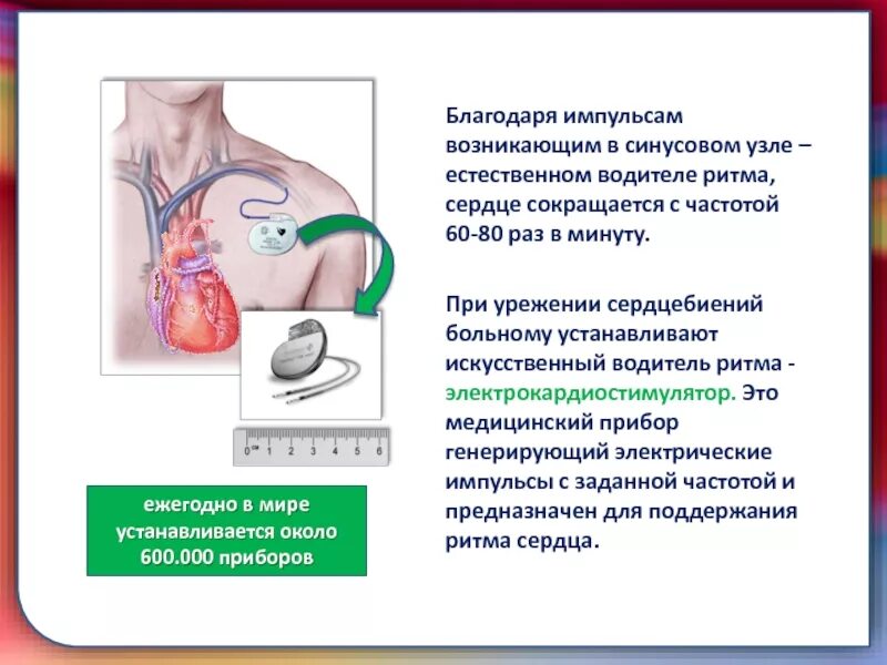 Искусственный водитель ритма. Водители ритма. водители ритма сердца. задатчик (водитель) сердечного ритма;. искусственный водитель сердца.