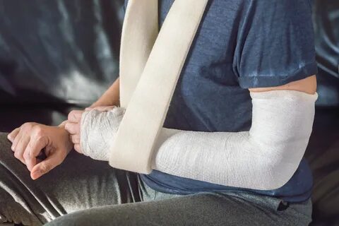 Про сломанную ногу