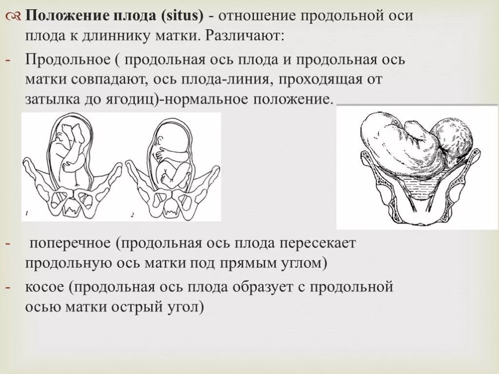 Продольная ось плода и продольная ось матки. Позиции плода в акушерстве. Продольное положение плода. Положение головки плода. Положение плода в матке продольное