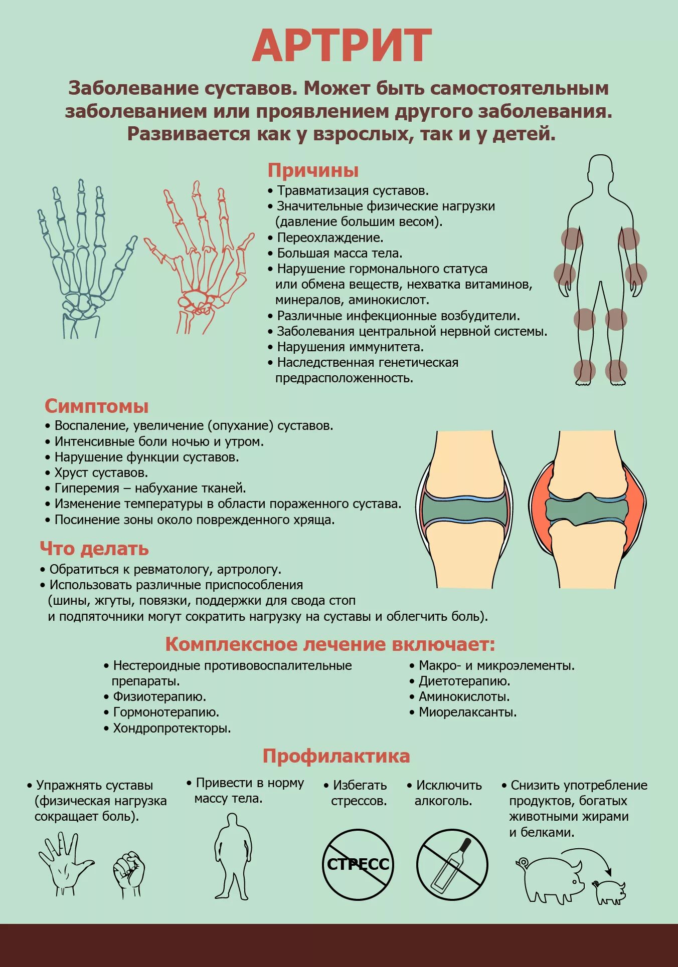 Хрустят суставы что принимать. Профилактика артрита. Профилактика ревматоидного артрита. Памятка для больных ревматоидным артритом.