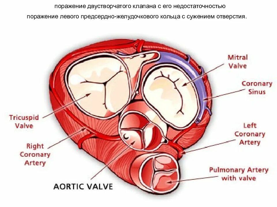 Двустворчатый клапан сердца. Митральный клапан двустворчатый. Двустворчатый клапан расположен между. Клапан правого предсердно желудочкового отверстия