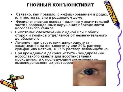 Коньюктивит глаза лечение
