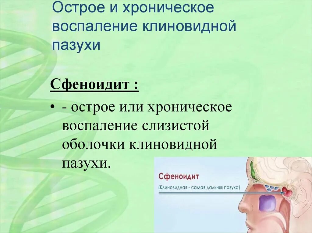 Хронический сфеноидит. Воспаление клиновидной пазухи. Острое и хроническое воспаление клиновидной пазухи. Околоносовые пазухи воспаление. Травмы носа и околоносовых пазух.