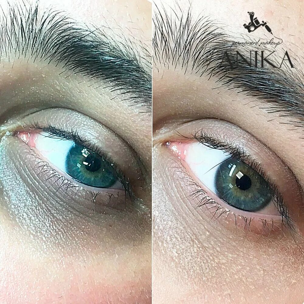 камуфляж под глаза. камуфляжный перманентный макияж. перманентный камуфляж синяков под глазами. макияж с темными кругами под глазами. перманентный консилер до после.