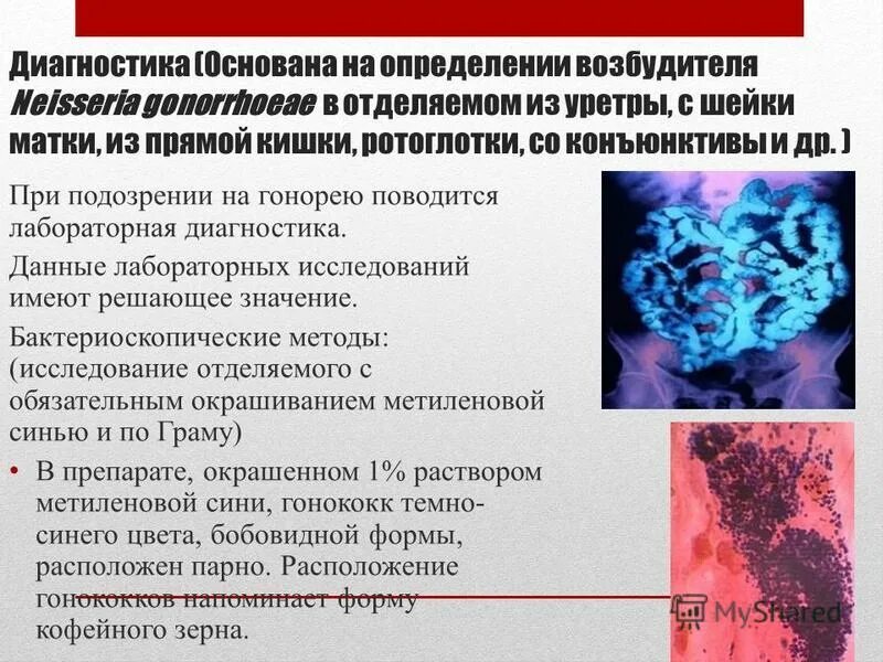 методы выявления мбт в мокроте. бактериоскопические методы выявления мбт. методы обнаружения микобактерий. метод выявления микобактерий туберкулеза. методы обнаружения микобактерий.