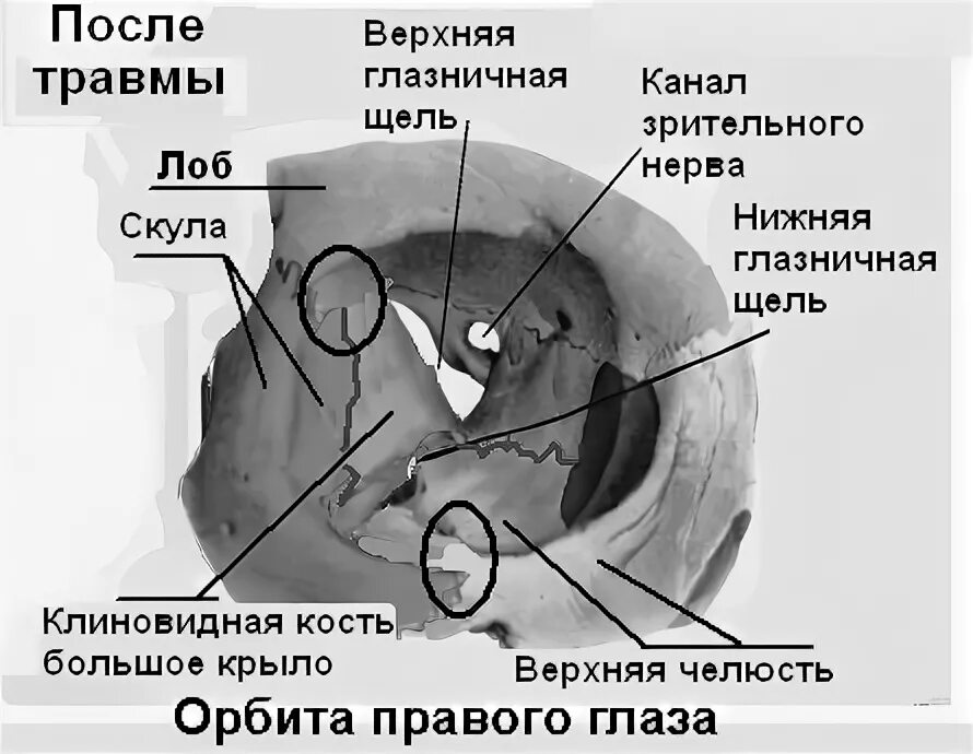 1 строение глазницы