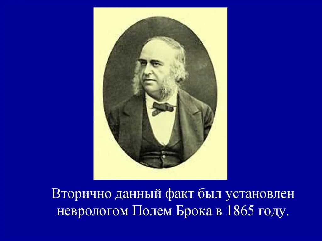 Поль Пьер Брока. Поль Брока французский хирург. Брока ученый. Поль Брока открытия. Поль брока