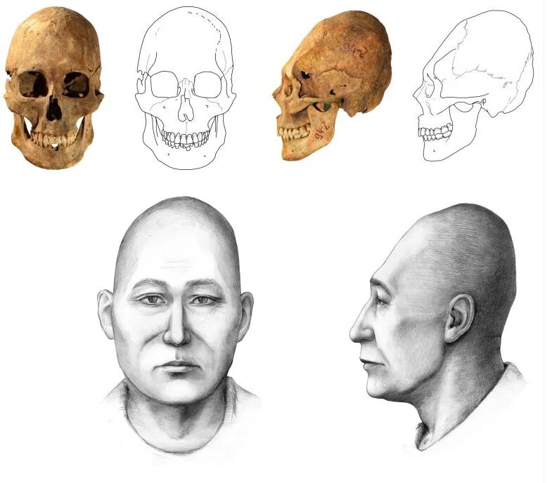 Брахицефалия антропология. Форма черепа. Формы черепа человека.