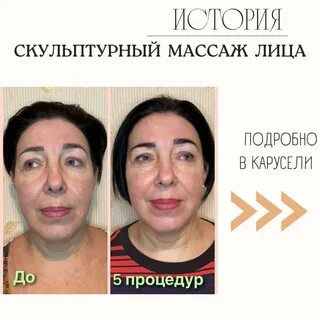 Скульптурный массаж до и после