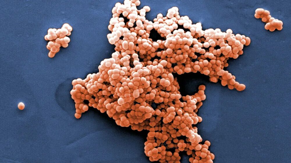 Staphylococcus viridans