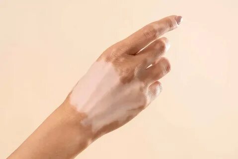 Wet fingers