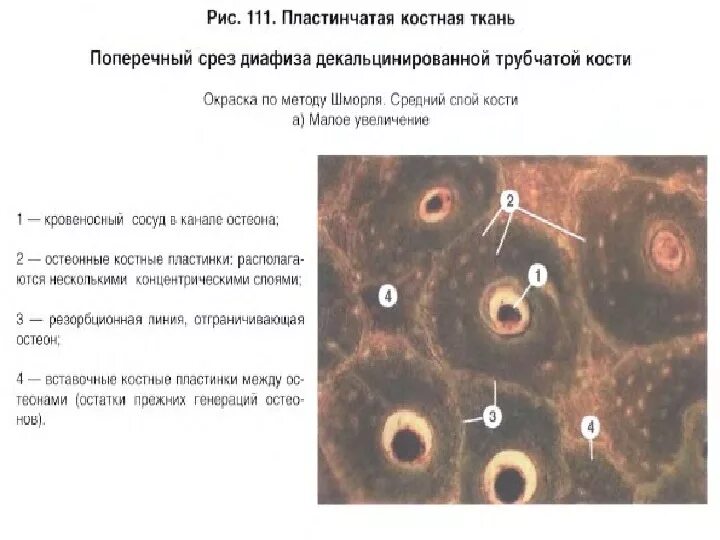 Поперечный срез трубчатой кости. Костная пластинчатая соединительная ткань. Пластинчатая костная ткань поперечный срез трубчатой кости. Пластинчатая костная ткань поперечный срез диафиза. Костная ткань поперечный срез диафиза.