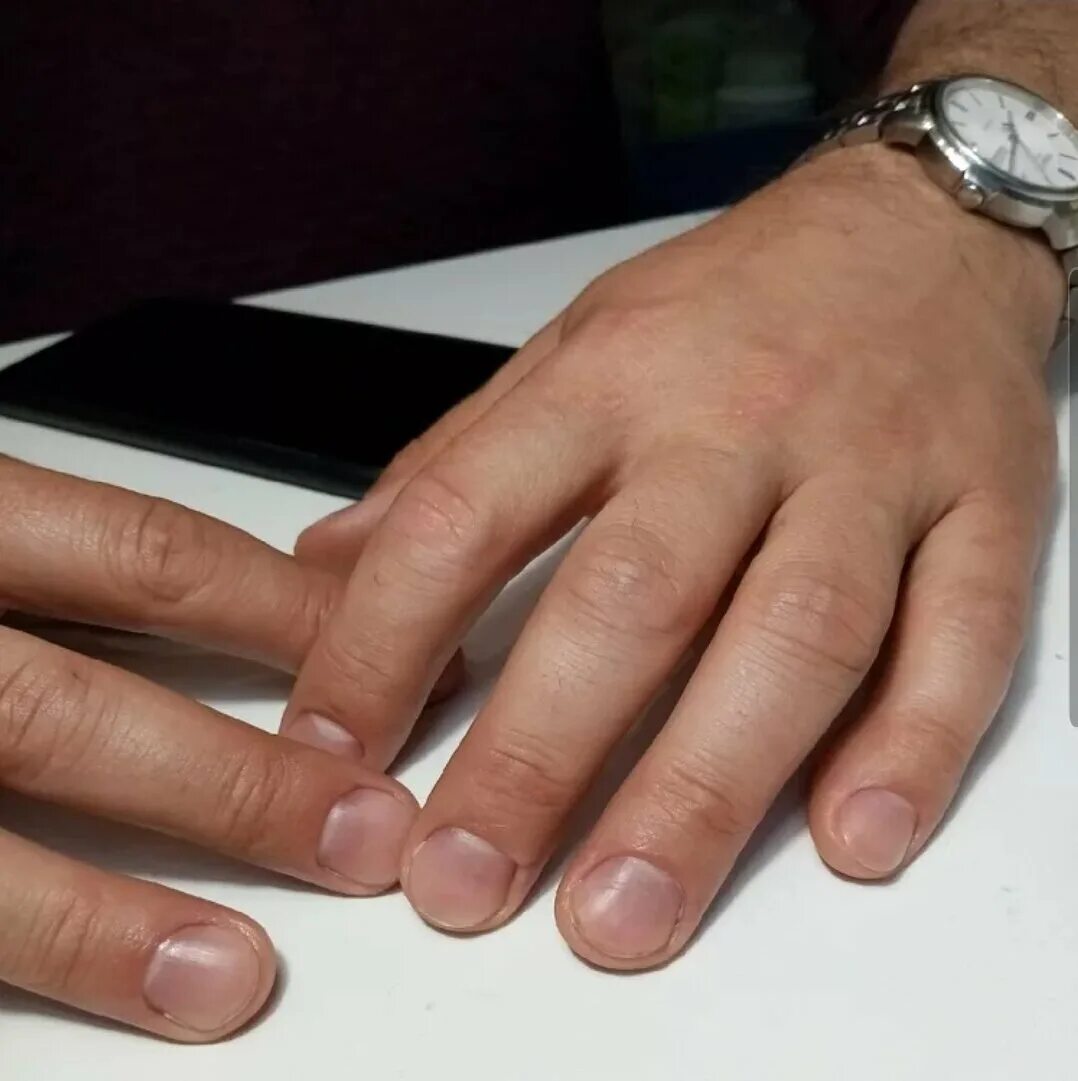manicure japoński Salud de las uñas, Consejos de manicure, Uñas amarillas