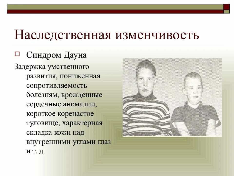 Какие есть синдромы дауна. Синдром Дауна Тип наследования. Синдром Дауна наследственное заболевание. Рождение ребёнка с синдромом Дауна форма изменичичости. Болезнь Дауна Тип наследования.