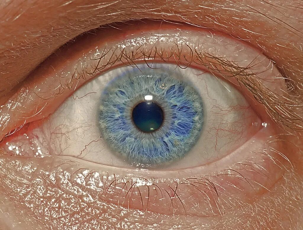 Здоровые глазки. Гетерохромия радужной оболочки. Здоровые глаза. Здоровый глаз человека. Что внутри зрачка.