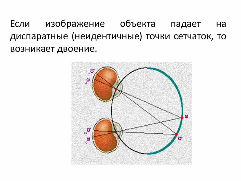 Диспарантные точки сетчатки. Корреспондирующие точки сетчатки. Корреспондирующие и диспаратные точки сетчатки. Бинокулярное зрение схема. Перед сетчаткой расположена