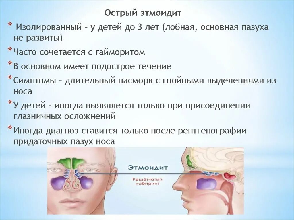 Правосторонний гнойный. Острый этмоидит этиология. Острый двухсторонний этмоидит. Этмоидит (воспаление решетчатой пазухи). Этмоидальный синусит симптомы.