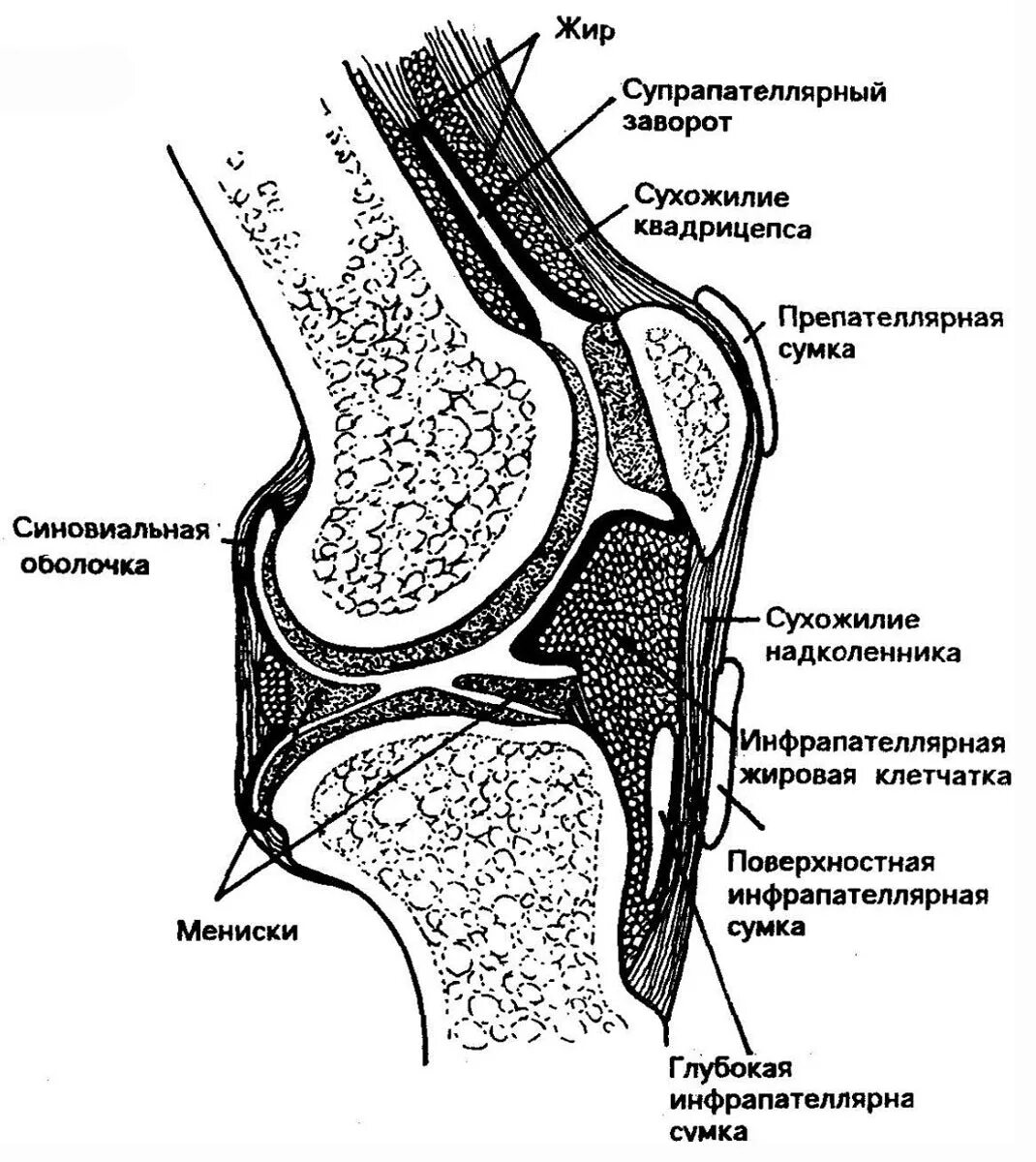 Синовиальные сумки коленного сустава анатомия. Супрапателлярный бурсит коленного сустава на кт. Супрапателлярная сумка коленного сустава жидкость. Синовиальные сумки коленного сустава на рентгене.