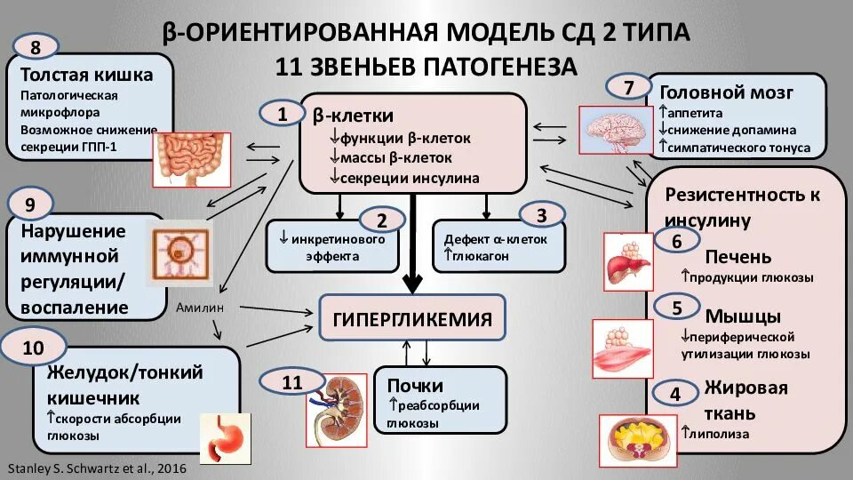 Гриппа сахарный диабет. Механизм развития сахарного диабета 2 типа схема. Механизм развития СД 2 типа. Механизм развития сахарного диабета 1 типа схема. Сахарный диабет 2 механизм развития.