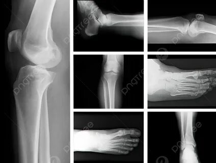 Жыныстық фото рентген