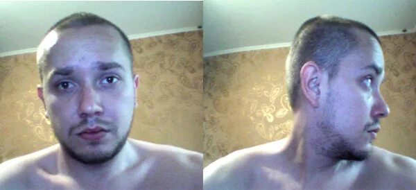 Как понять пойдет. Стрижка налысо с залысинами и бородой. Мужская стрижка налысо с челкой. Налысо до и после мужчины. Идет ли лысина мужчине.