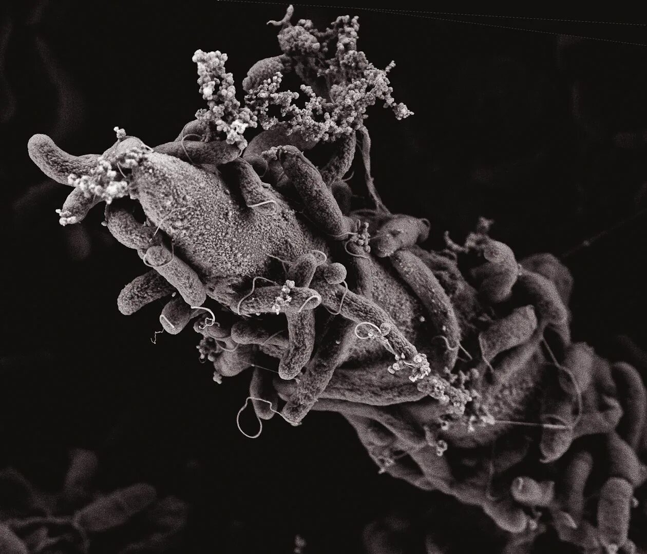 Рубцовые бактерии. Холерный вибрион в микроскопе. Микроб холеры под микроскопом. Вибрион холеры под микроскопом. Vibrio cholerae микроскопия.