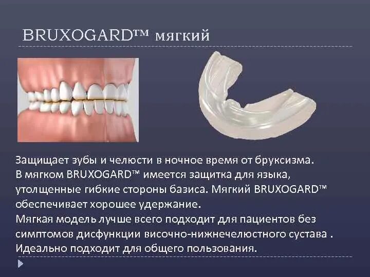 Капы для нижнечелюстного сустава. От бруксизма для зубов. Сильно сжатые зубы