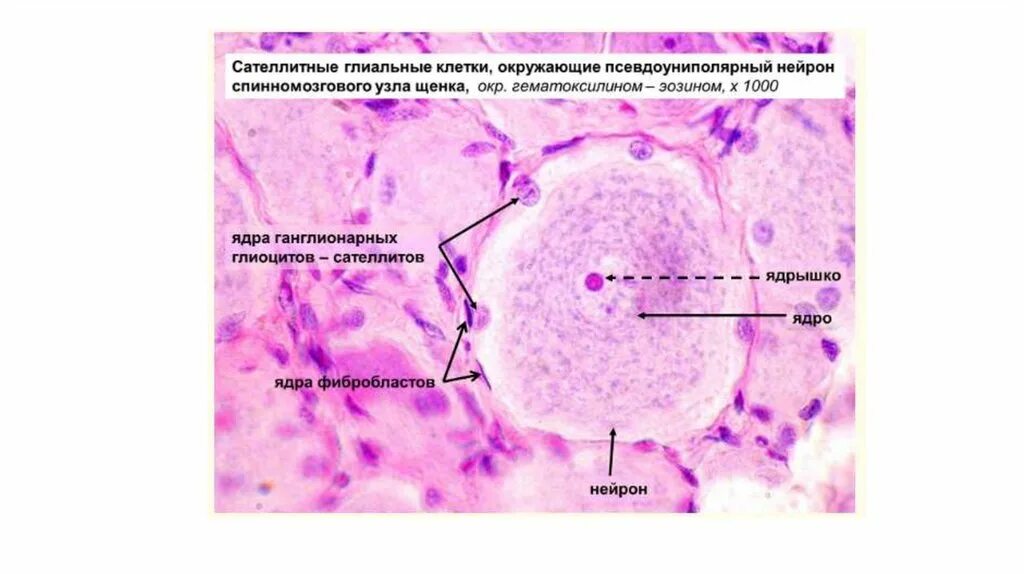 Клетки спинномозгового узла. Псевдоуниполярные Нейроны спинального ганглия препарат. Спинномозговой ганглий гистология препарат. Нейрон гистология препарат. Нейроцит гистология препарат.