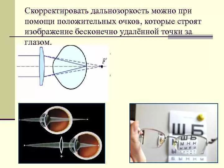 Как подобрать очки для зрения при дальнозоркости. Очки для дальнозоркости. как скорректировать дальнозоркость. диоптрии близорукости и дальнозоркости. очки для близорукости и дальнозоркости.