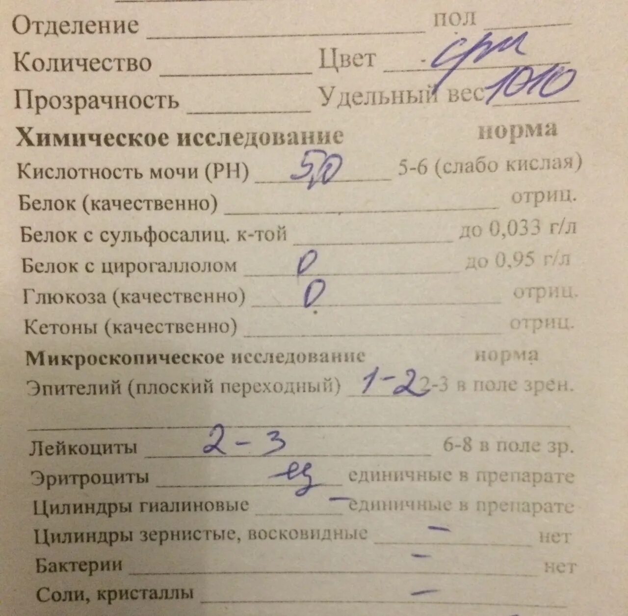 Анализ мочи норма у мужчин после 60. Общий анализ мочи показатели нормы. Общий анализ мочи норма. Исследование мочи общий анализ норма. Общий анализ мочи норма анализов.