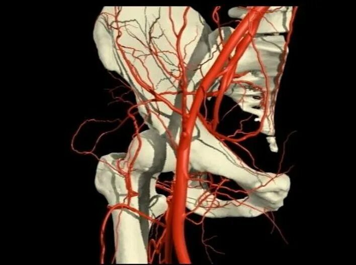 Препараты кровообращение малого таза. Подвздошные вены анатомия. Подвздошная артерия 3д. Кровоснабжение малого таза вены. Вены малого таза анатомия.