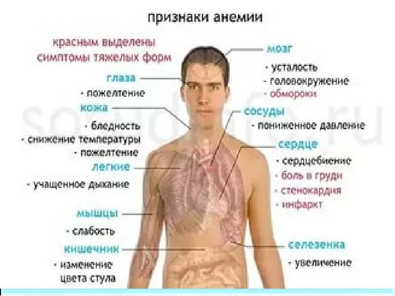 Анемия головокружение. Анемия низкий гемоглобин. Слабость и потливость без температуры