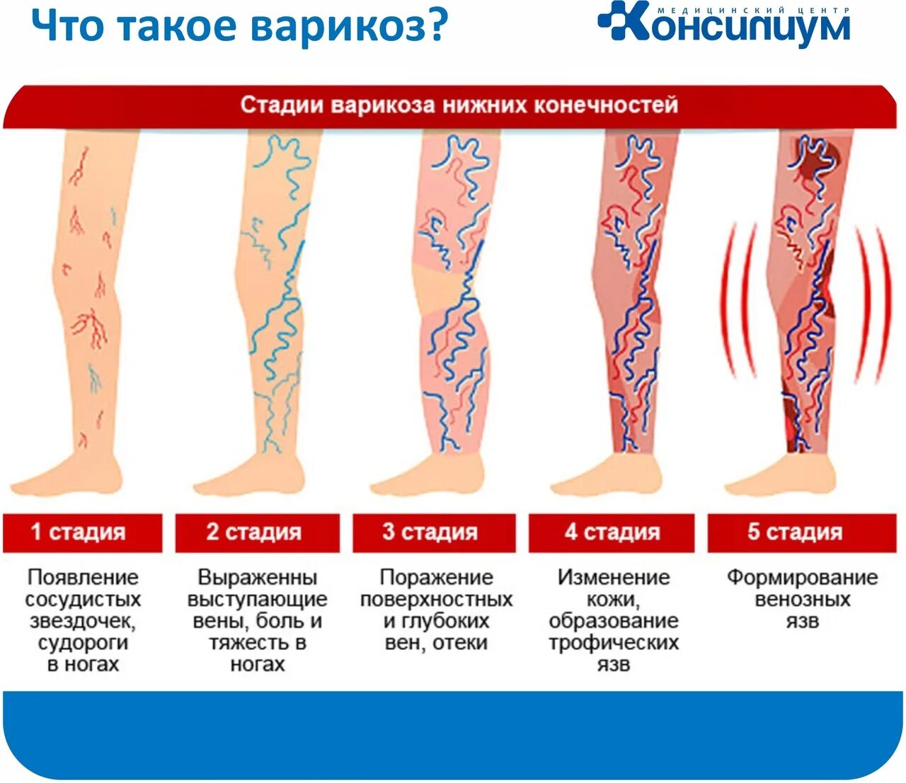 Какая нога сильнее