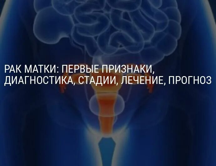 РШМ на первых стадиях преимущественно распространяется. Насколько страшна онкология матки. Онкология матки у женщин что делают. Онкология матки лечение