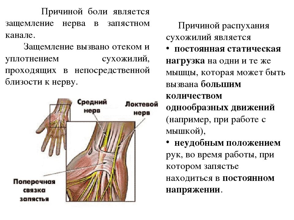 Немеет правое предплечье причины