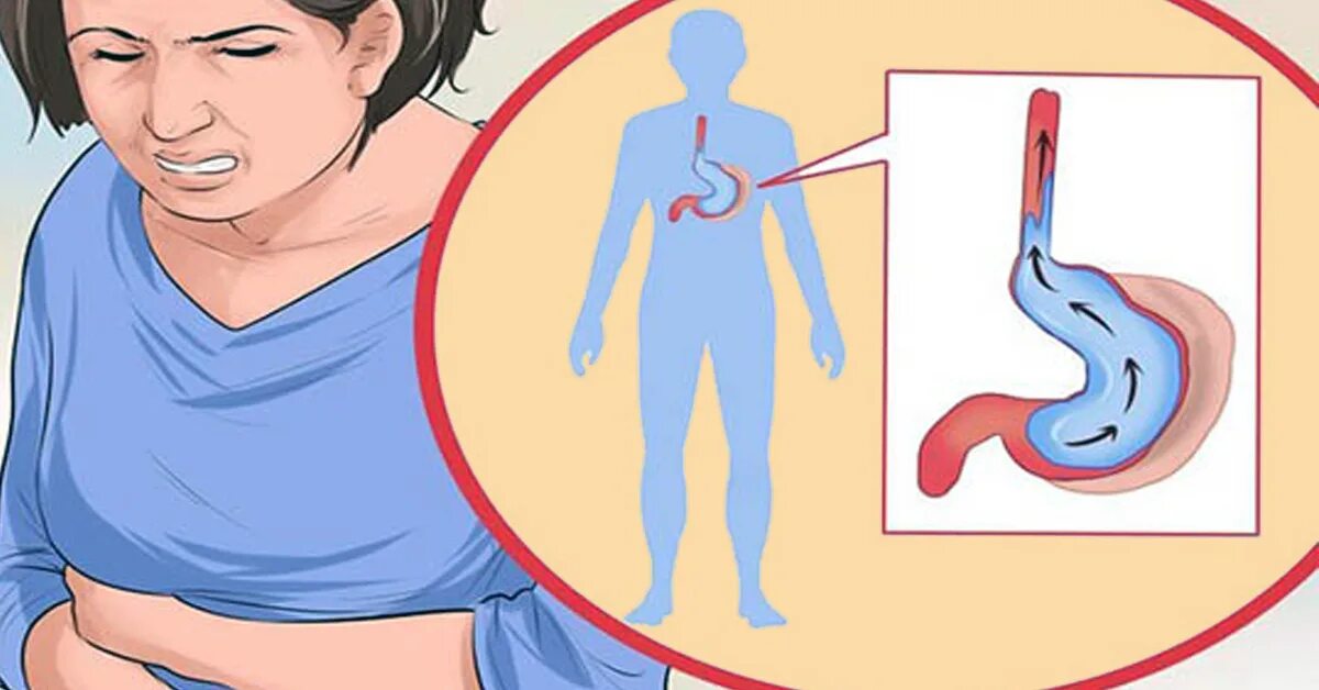 Изжога в горле пищеводе. Изжога в пищеводе и горле.