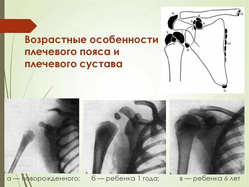 Плечевой сустав у детей. Рентгеноанатомия плечевого сустава. плечевой сустав рентген анатомия. анатомия плечевого сустава у детей.