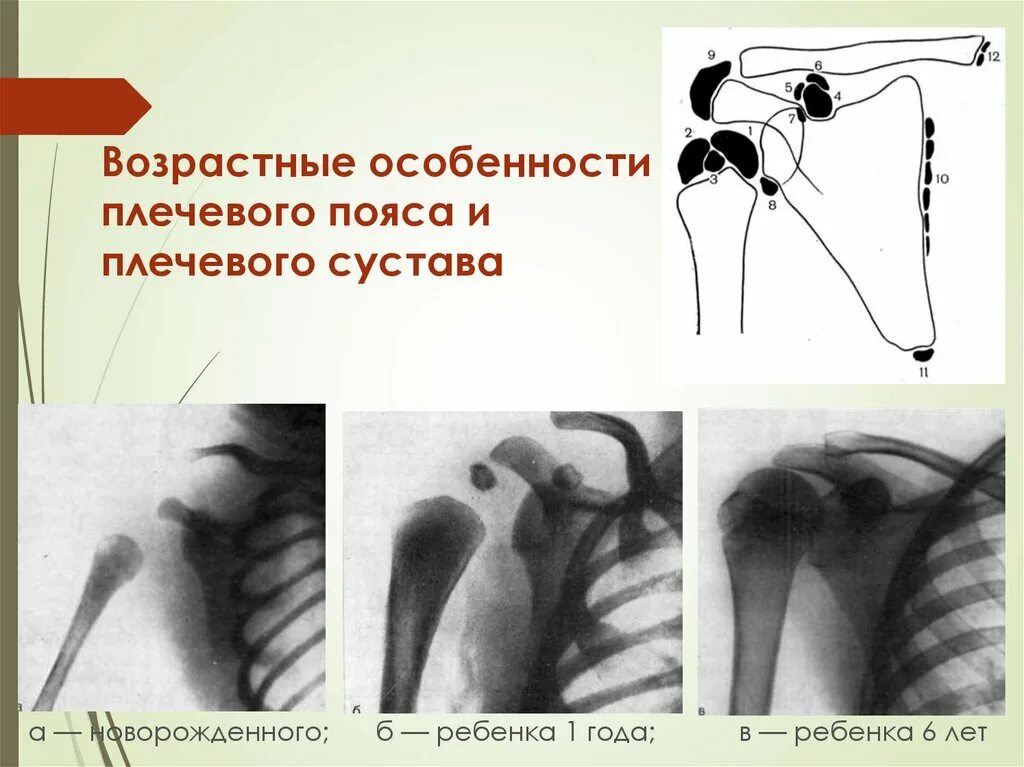 Плечевой сустав ребенка