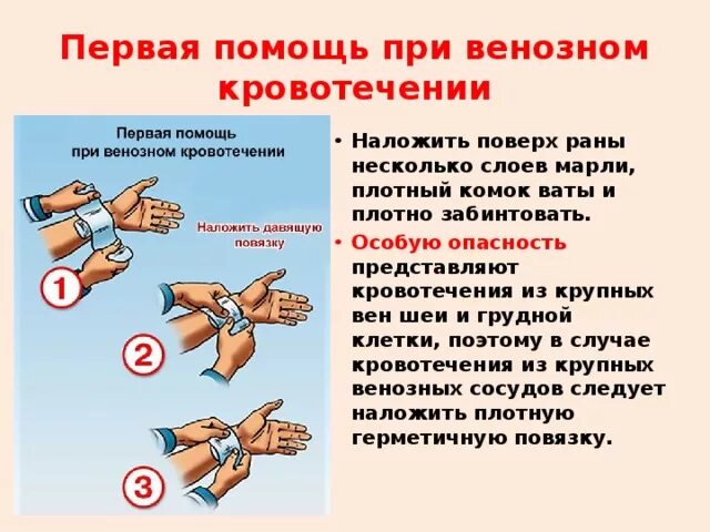 При сильном кровотечении нужно. ПМП при артериальном и венозном кровотечениях. Оказание 1 помощи при артериальном и венозном кровотечении. Оказание первой медицинской помощи при венозном кровотечении. Алгоритм оказания ПМП при венозном кровотечении.