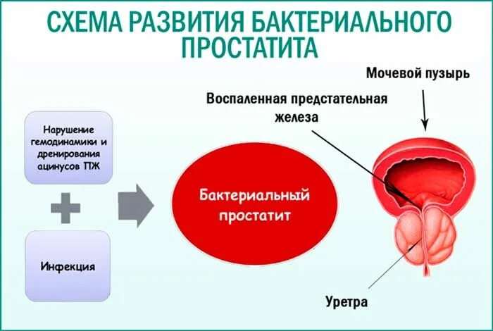 Бактериальная простата
