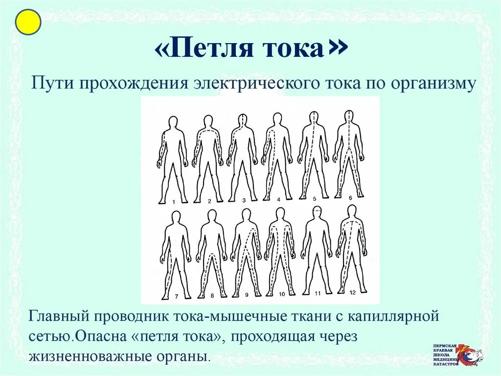 Какие петли тока наиболее опасны. Пути прохождения электрического тока через тело. Пути прохождения тока через тело человека. Путь («петля») тока через тело человека. Схемы прохождения электрического тока через тело человека.