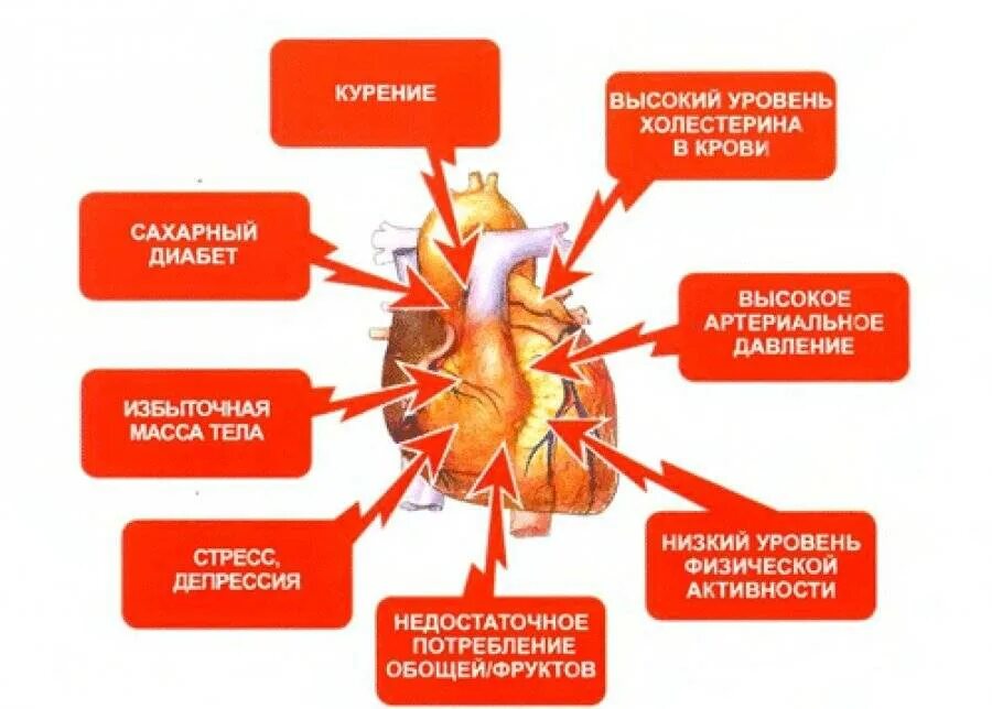 Является причиной сердечных заболеваний. Факторы риска развития заболеваний ССС. Каковы факторы риска сердечно-сосудистых заболеваний?. Факторы влияющие на сердечно сосудистые заболевания. Схема факторы риска сердечно-сосудистых заболеваний.