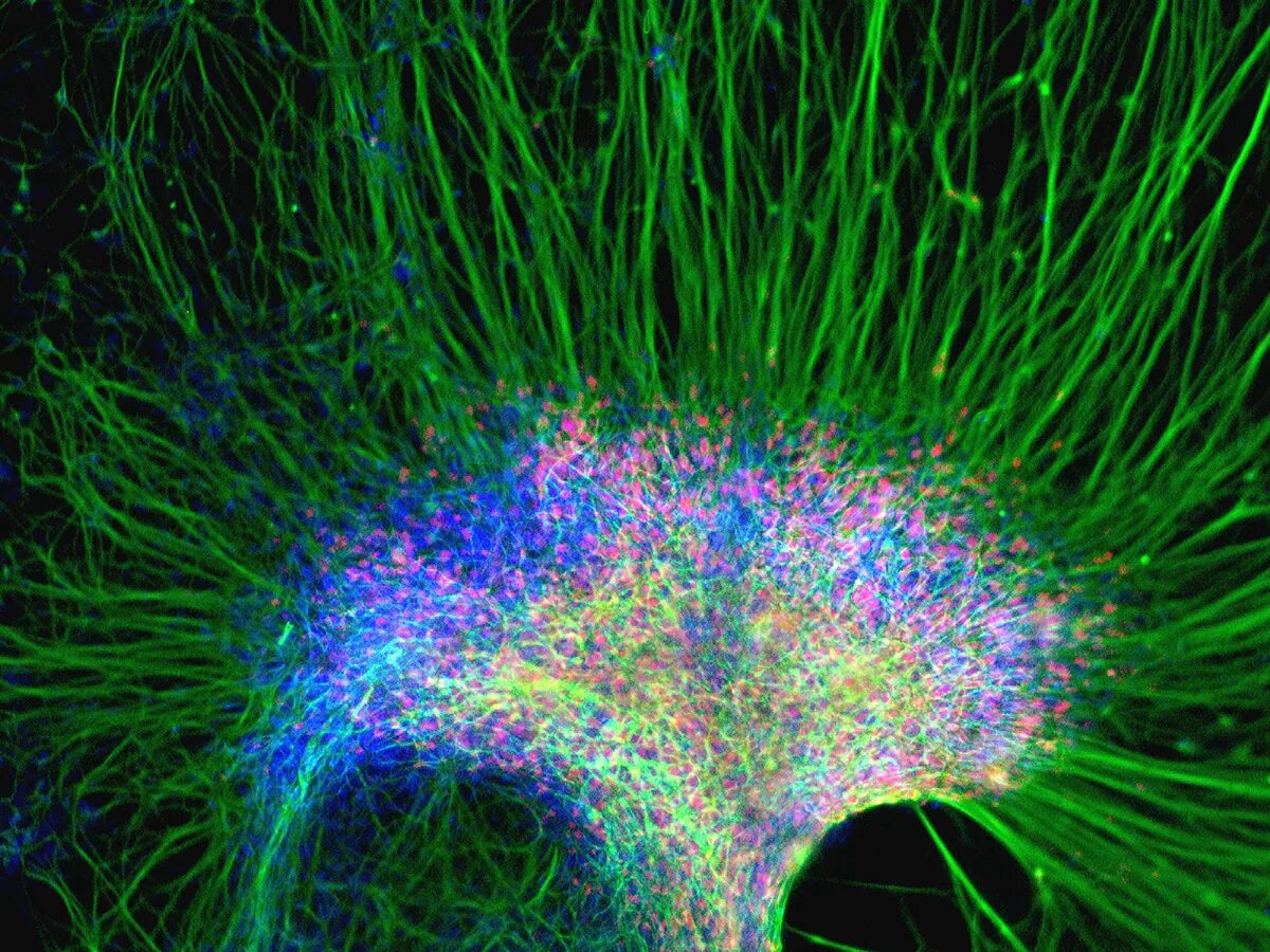 Нейронные боеприпасы. Цитоскелет флуоресцентная микроскопия. Нейрональные стволовые клетки. Нейроны мозга под микроскопом. Нейрональная стволовая клетка.