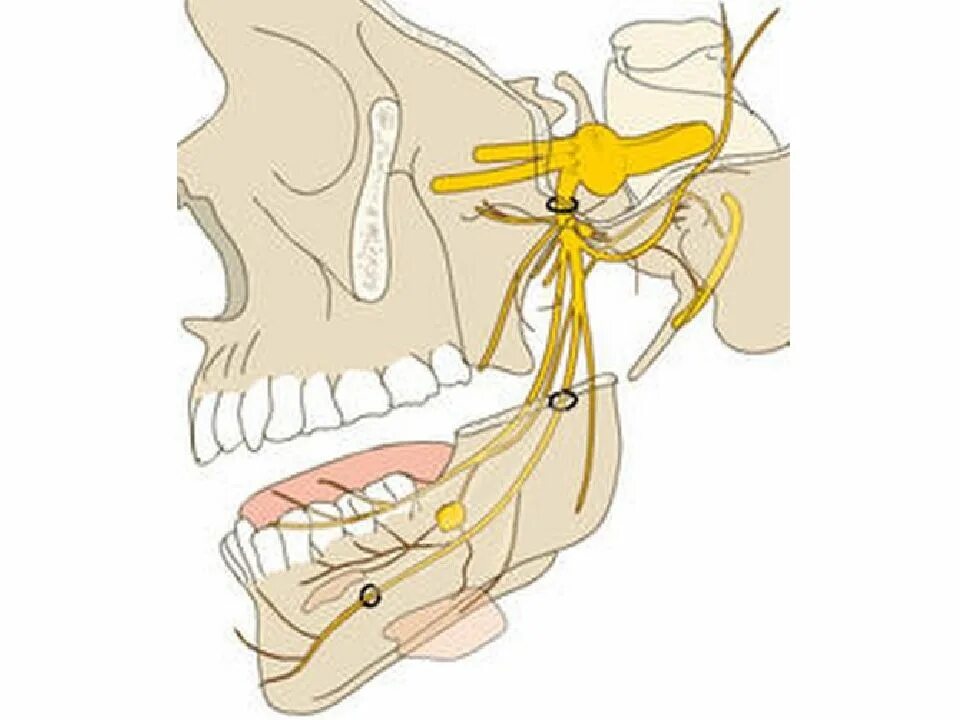 Нижнечелюстной тройничный нерв анатомия. Менингеальная ветвь нижнечелюстного нерва. Челюстно подъязычный нерв анатомия. Нижнечелюстная ветвь тройничного нерва. Лицевой нерв челюсти