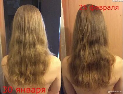 Почему волосы темнеют с возрастом