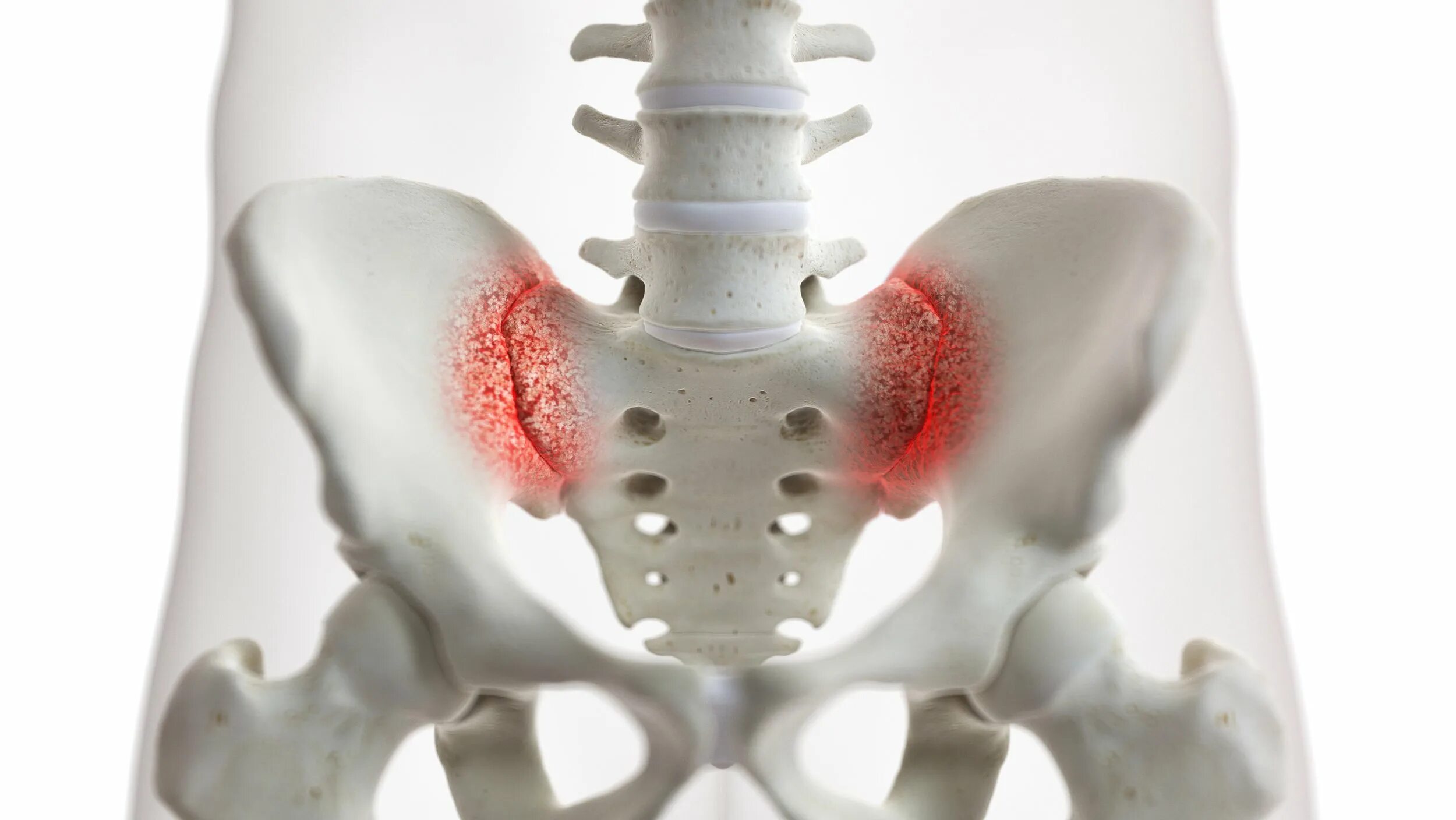 Sacroiliac Joint x Rai. Болит тазовая кость справа